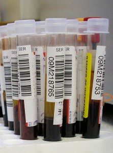 A simple blood test can check for the presence of Syphilis in the body.