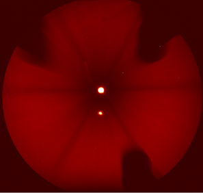 The top spot is the artificially created laser guide star in the mesosphere with sodium atoms excited by the laser. The star pattern and surrounding lopes, seen by the acquisition camera, show the structures of the telescope and the equipment in the light path. The bottom spot is a reflection of the laser star on the camera optics. W. M. Keck Observatory photo.