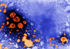 Hepatitis virons. Author: Dr. Erskine Palmer, USCDCP